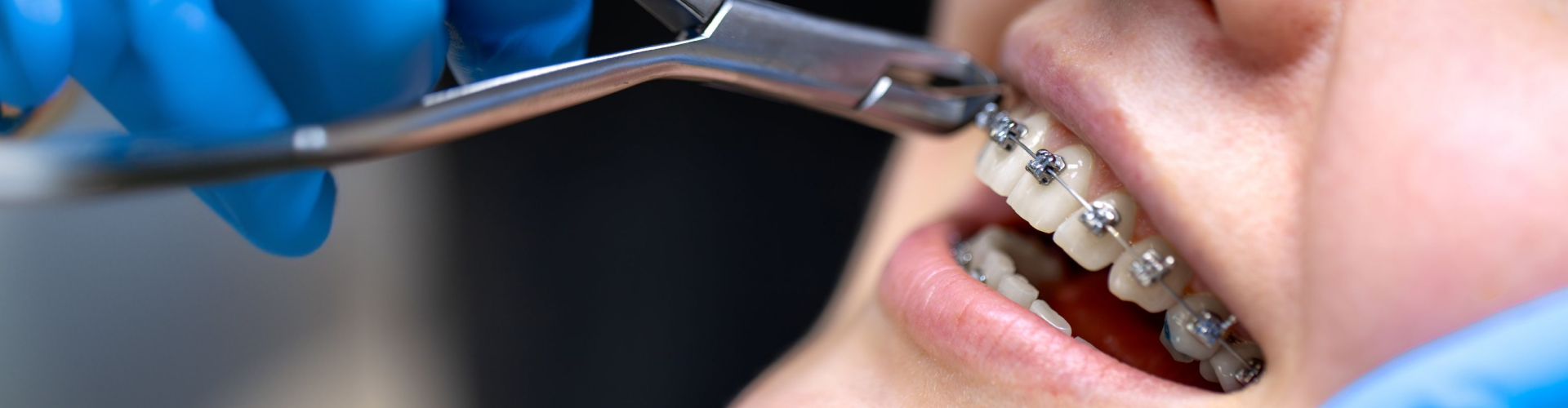 Orthodontist adjusting traditional metal braces during a routine orthodontic appointment.